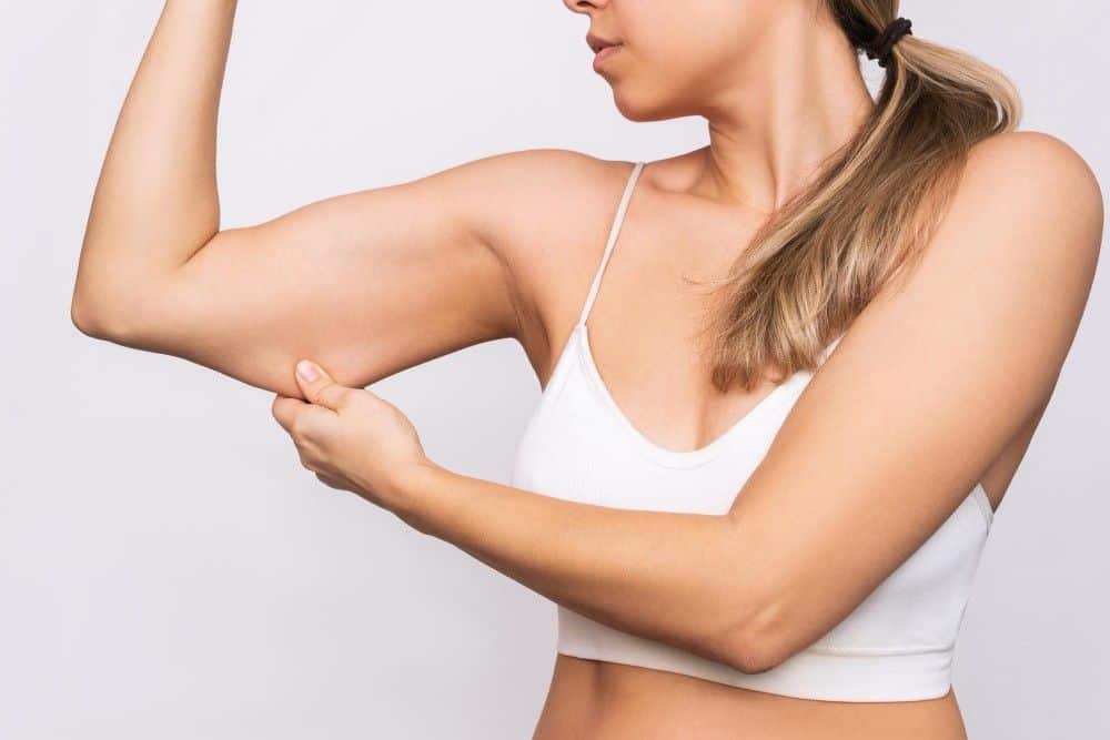 Woman showcasing toned arm after plastic surgery in Albania for cosmetic enhancement.