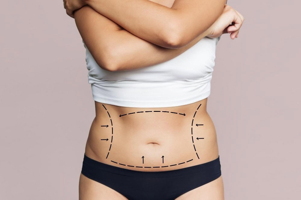 Enhancing body contours through advanced plastic surgery options in Albania for optimal aesthetic re.