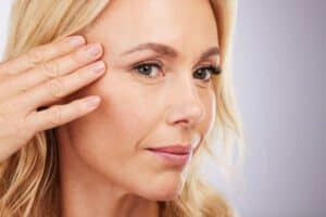 The best chemical peel for removing wrinkles - deep chemical peel in Albania