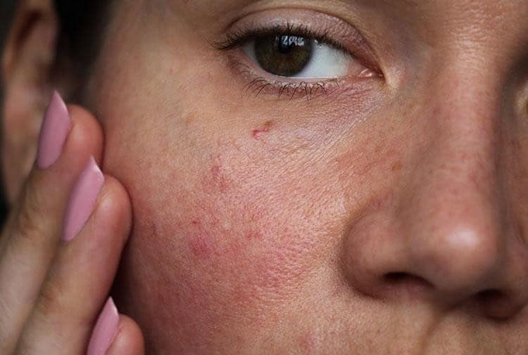 Anti-Ageing Skin Treatments in Albania for Women.
