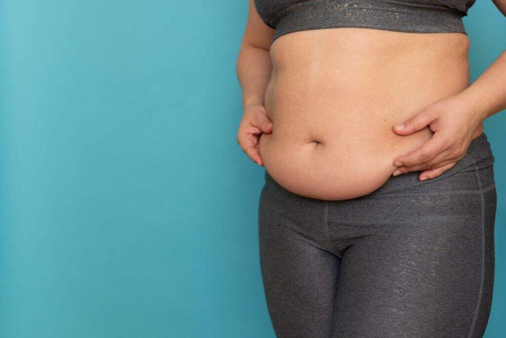Woman with excess belly fat, promoting medical tourism in Albania for weight loss solutions.