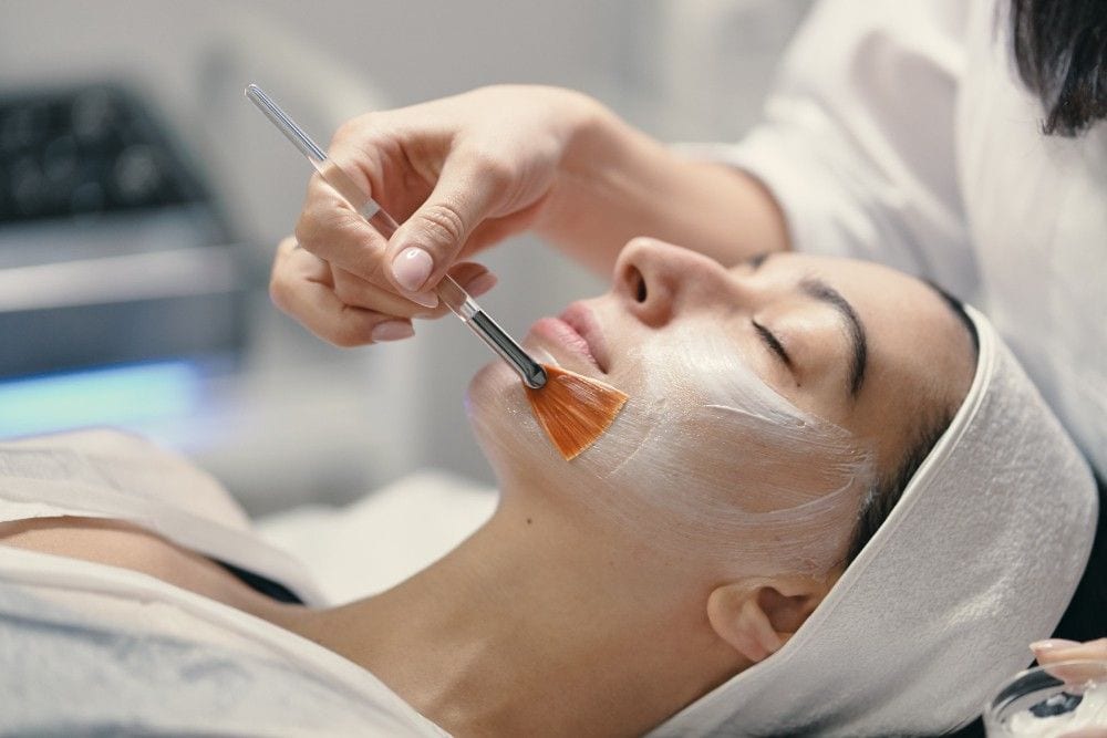 Chemical peel for acne scars, sun damage, and skin rejuvenation in Albania.