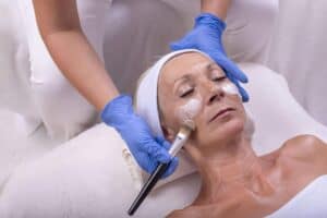 Affordable cosmetic surgery in Albania, deep chemical peels for removing wrinkles