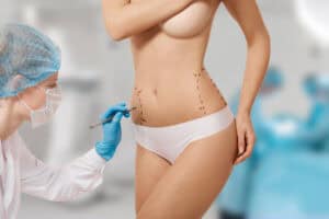 Woman receiving cosmetic surgery consultation in Albania clinic.