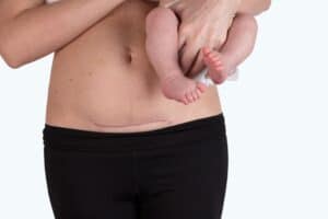 Frau mit einem Neugeborenen auf dem Bauch, Fokus auf die postpartum-Erholung.