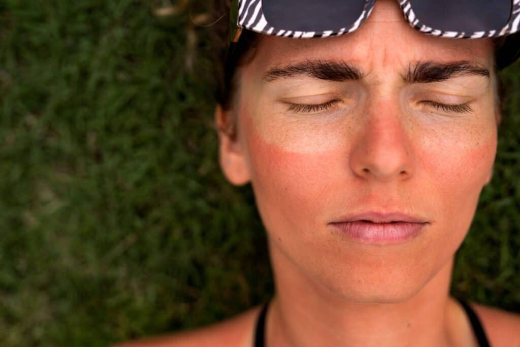 Sun damage signs on skin, addressing skin health through medical tourism in Albania.