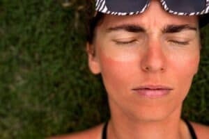 Sonnenschäden auf der Haut, Förderung der Hautgesundheit durch Medizintourismus in Albanien.