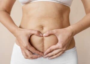 Erschwingliche Mommy-Makeover-Operation in Albanien