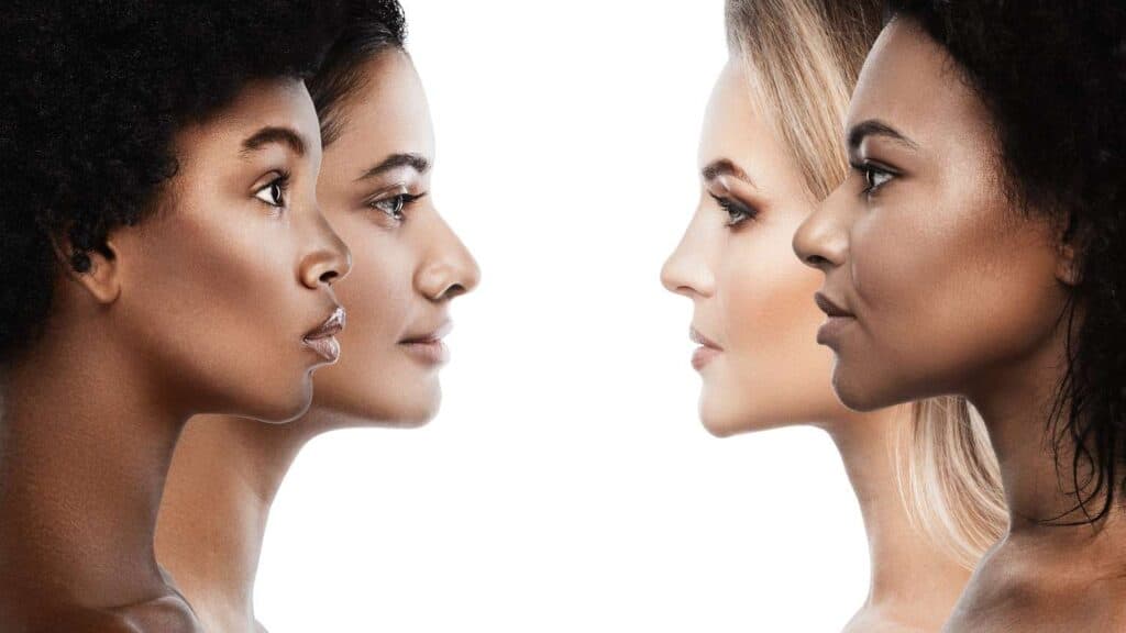 Close-up of four women with different nose shapes, showcasing various rhinoplasty options.