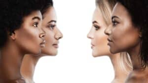 Nahaufnahme von vier Frauen mit unterschiedlichen Nasenformen, die verschiedene Nasenkorrekturoptionen zeigen.