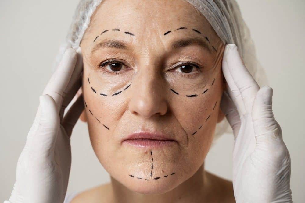 Lifting facial à plan profond vs. lifting facial traditionnel pour des résultats rajeunissants.