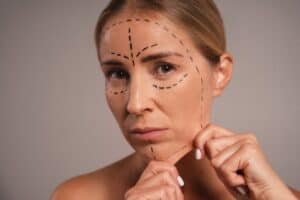 lifting facial asequible en Albania para arrugas y piel flácida