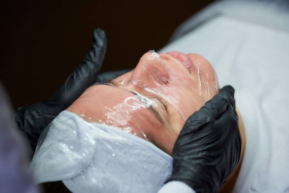 Femme recevant un traitement de rajeunissement cutané profond avec un peeling à l'huile de croton phénolique.