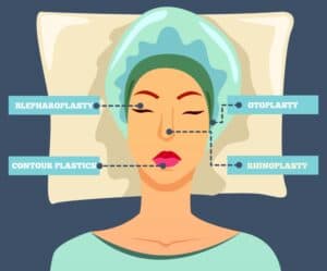 Mujer sometiéndose a múltiples cirugías plásticas en Albania para mejorar su estética.