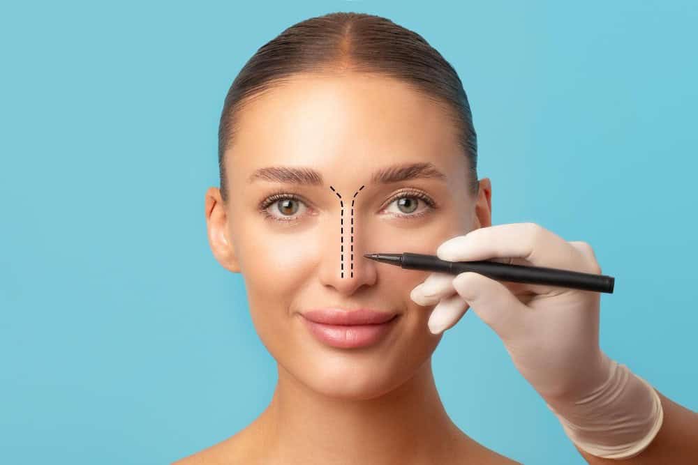 Visage de femme avec des marques pour des procédures esthétiques, promouvant le tourisme médical en Albanie.