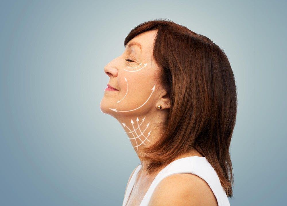 Femme avec des marques faciales pour des procédures de lifting, faisant la promotion du tourisme médical en Albanie.