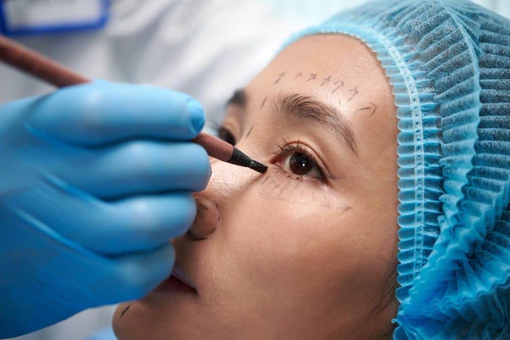 Femme subissant une procédure cosmétique de rajeunissement facial en Albanie.