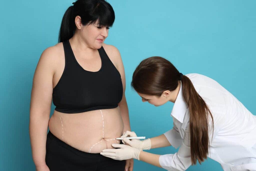 Femme recevant une consultation pour une chirurgie esthétique en Albanie pour un "mommy makeover".