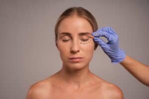 Vrouw ondergaat consultatie voor ooglidcorrectie in Albanië voor blefaroplastie.