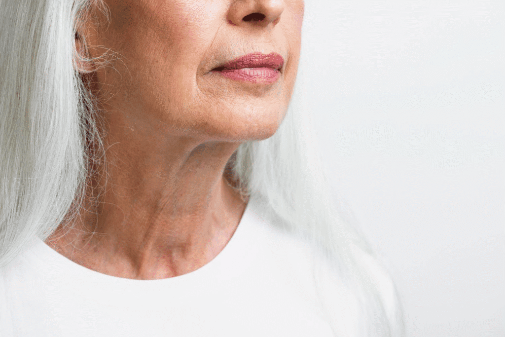 Woman with a youthful neck after a neck lift procedure in Albania.