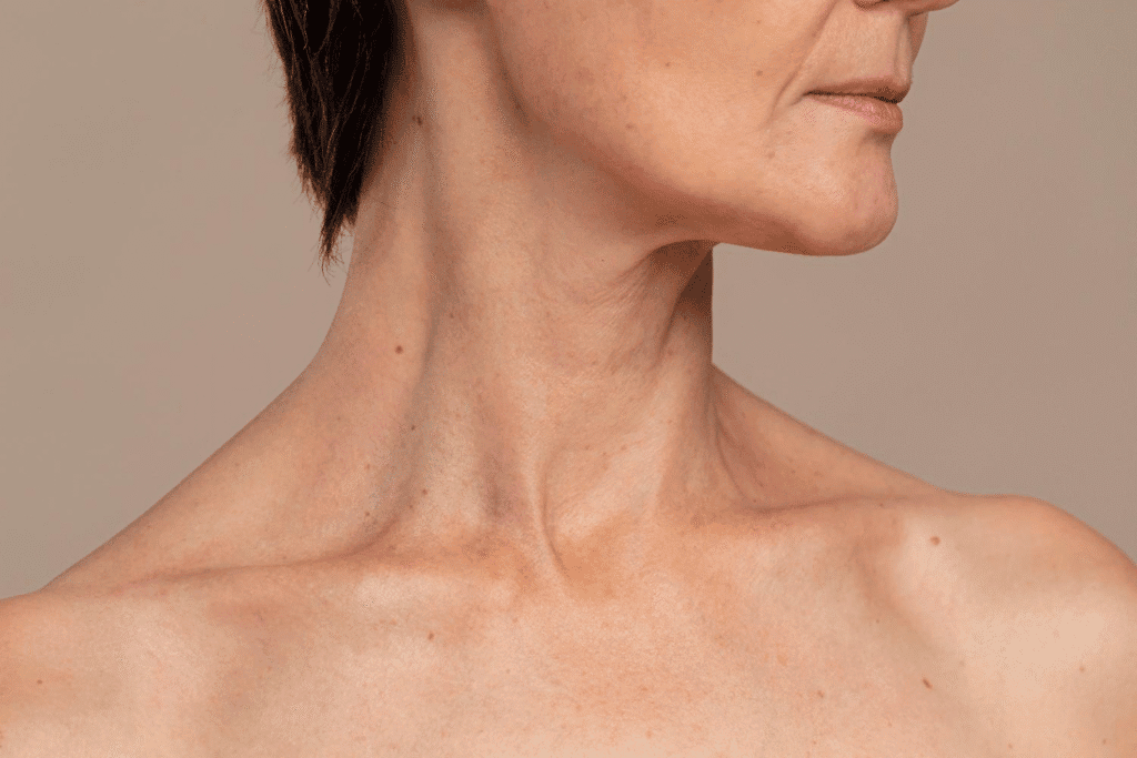 Woman's neck after neck lift surgery in Albania, showing smooth skin.
