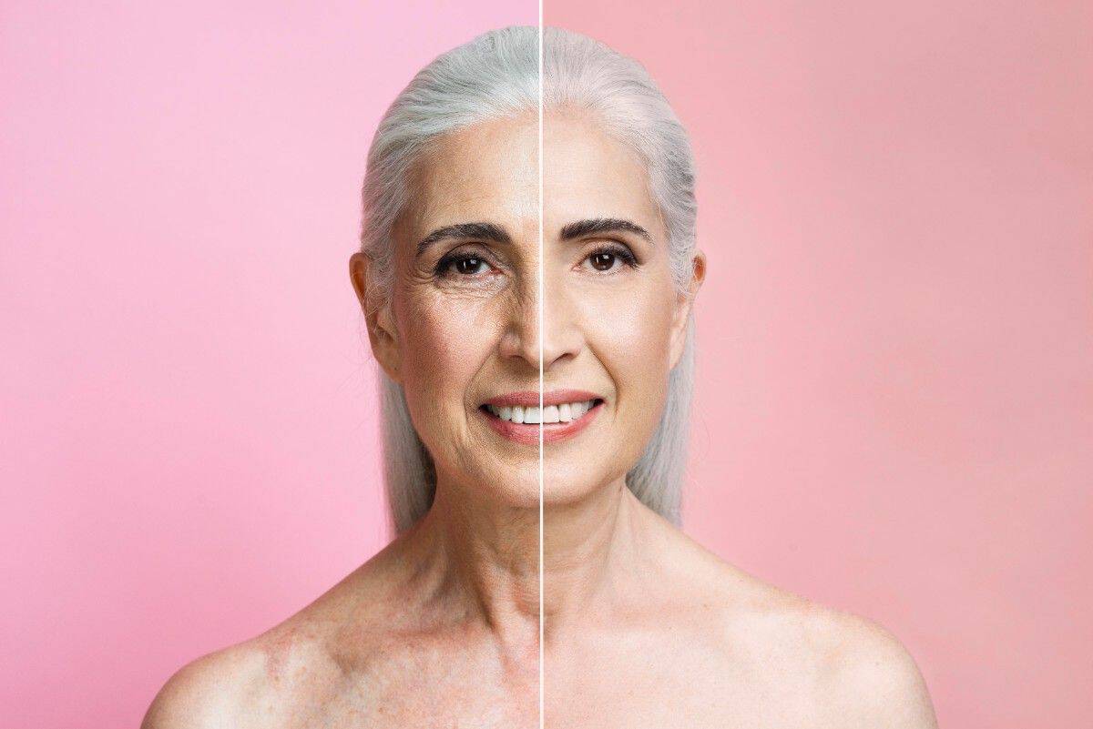 Prima e dopo il lifting in Albania