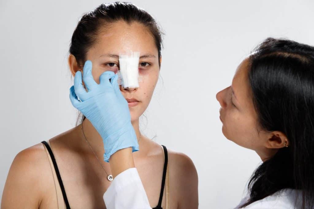 Vrouw die in Albanië medische zorg ontvangt voor een neuscorrectie (rhinoplastie).