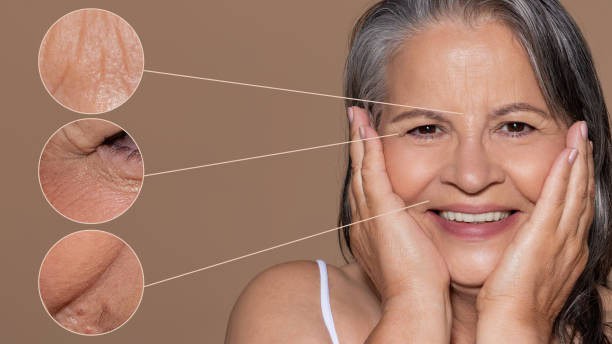 Grua me lëkurë të moshuar, që tregon efektet e moshës, cilësisë së lëkurës dhe mënyrës së jetesës.