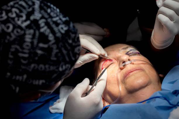 Medical procedure in Albania for affordable healthcare and quality surgical services.