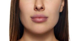 Nahaufnahme von Lippen und Kinn einer Frau, mit Hervorhebung von kosmetischen Behandlungsoptionen in Albanien.