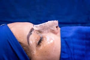 Medisch toerisme in Albanië: geavanceerde oogchirurgie en cosmetische behandelingen.