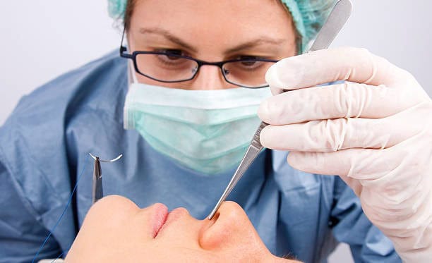 Chirurgien pratiquant une rhinoplastie en Albanie pour l'amélioration esthétique du nez.