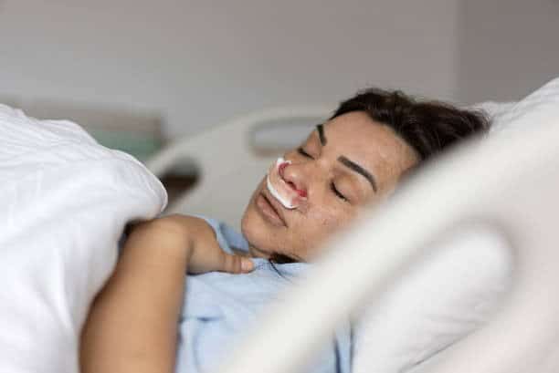 Patient se reposant après une rhinoplastie ou une septorhinoplastie en Albanie.