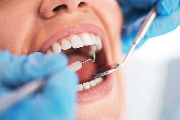 Nahaufnahme von Lippen und Kinn einer Frau, die kosmetische Behandlungsoptionen in Albanien hervorhebt.
