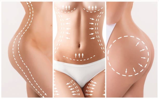 Body contouring and cosmetic surgery in Albania for medical tourism.