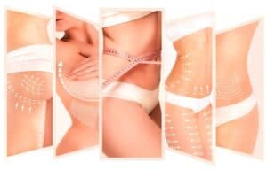Body contouring and cosmetic surgery for medical tourism in Albania.