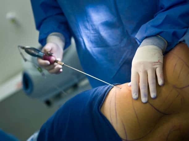 Medische procedure in Albanië voor internationale patiënten, met geavanceerde gezondheidszorgdiensten.