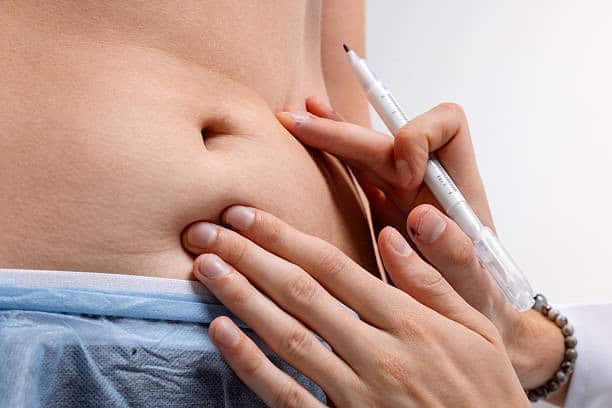 Medical procedure in Albania for health tourism and cosmetic treatments.