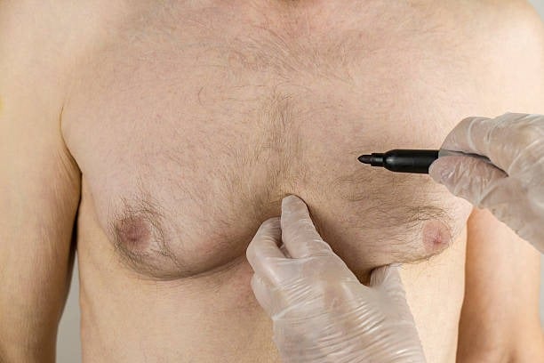 Medical professional preparing for a cosmetic breast procedure in Albania.