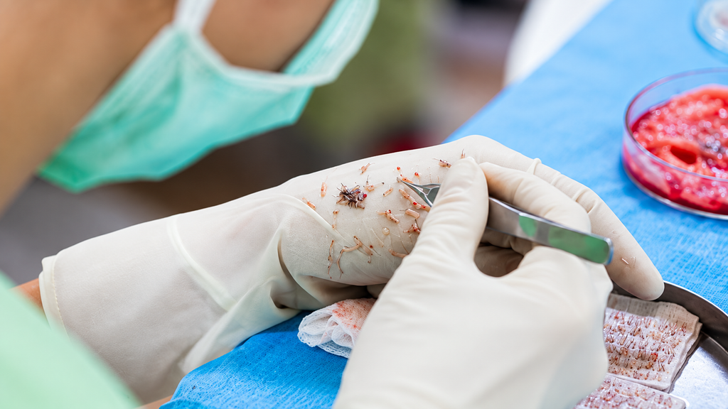 Medical professional performing a surgical procedure with precision tools.