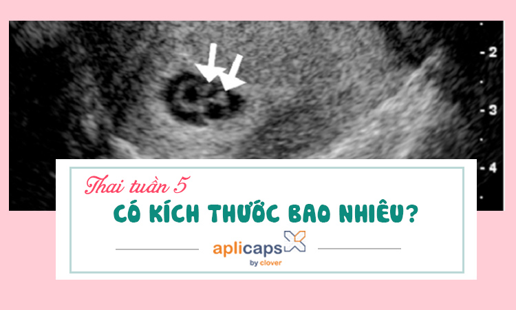 thai-tuan-5-co-kich-thuoc-bao-nhieu