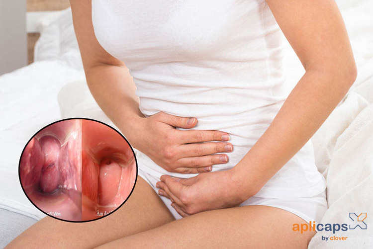 Nguy cơ nhiễm khuẩn sau sảy thai