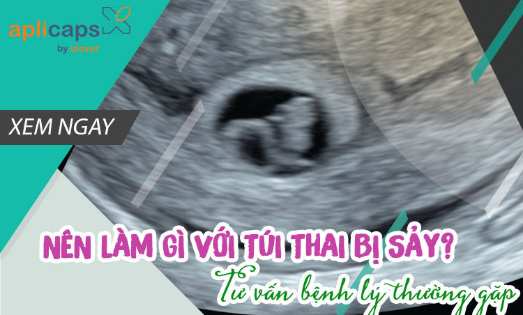 nên làm gì với túi thai bị sảy