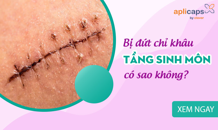 Bị đứt chỉ khâu tầng sinh môn có sao không