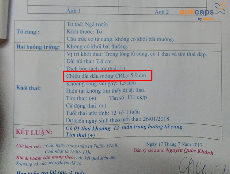 crl trong siêu âm thai là gì