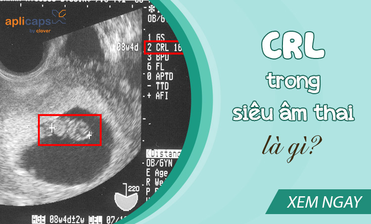 CRL trong siêu âm thai là gì