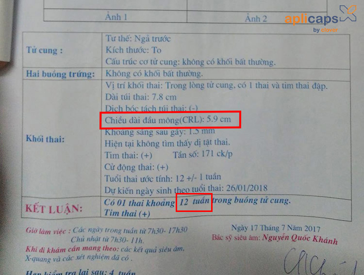 Giấy siêu âm thai 12 tuan có CRL