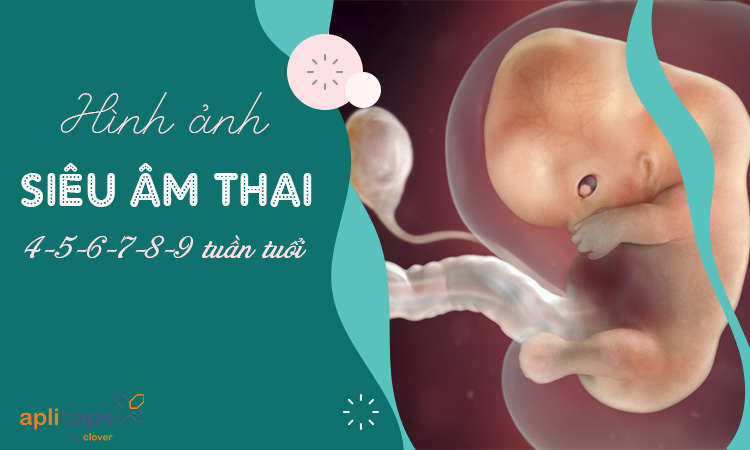 hình ảnh siêu âm thai 4-5-6-7-8-9 tuần tuổi