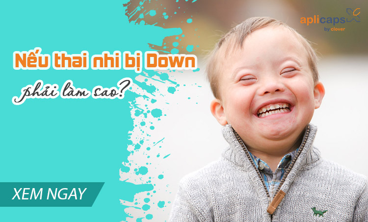 nếu thai nhi bị down phải làm sao