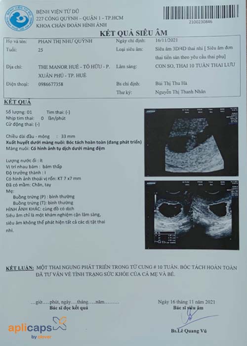 Giấy siêu âm 10 tuần